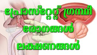 പ്രോസ്റ്റേറ്റ് ഗ്രന്ഥി രോഗങ്ങൾ ലക്ഷണങ്ങൾ Prostate diseases symptoms  Dr R Vijayan  Arogyavicharam [upl. by Hound716]