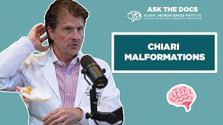 Ask the Docs 🥼🧠  Chiari Malformations with Dr Erol Veznedaroglu [upl. by Jago]