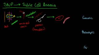 The Curious Case of Sickle Cell Anemia [upl. by Annawad60]