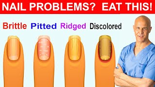 NAIL PROBLEMS  EAT THIS  Dr Mandell [upl. by Samot]