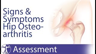 Signs and Symptoms of Hip Osteoarthritis [upl. by Eidson]