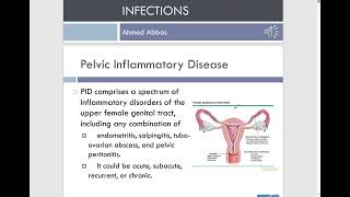 Clinical Genitourinary  PID [upl. by Erickson]