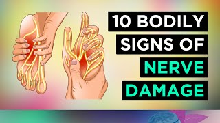 10 Signs of NERVE DAMAGE and How To Repair Nerves [upl. by Verlee]