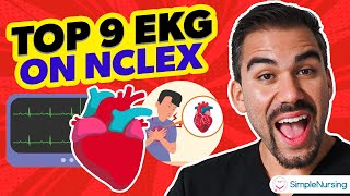 EKG Rhythms  Top Tested NCLEX Review  How To Interpret [upl. by Barry713]