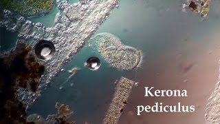 Kerona pediculus [upl. by Karina]