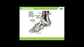 Tibialis Posterior Dysfunction Anatomy Causes amp Management [upl. by Ateuqahs]