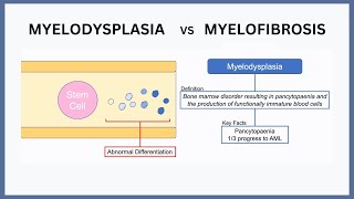 Myelodysplasia vs Myelofibrosis Explained [upl. by Ahsyt]