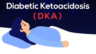 A real case of Diabetic Ketoacidosis DKA amp Management [upl. by Yenetruoc]