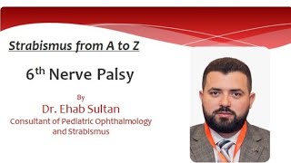 6th nerve palsy [upl. by Salohcim]