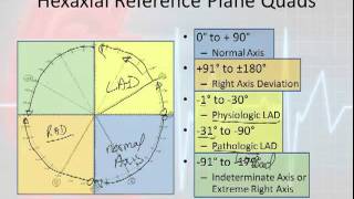 12 Lead Interpretation Part 3 Rwave Progression Electrical Vectors amp Axis Deviations [upl. by Arodnahs]