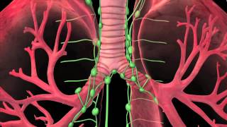 Florida Hospital Kissimmee Lung Cancer Treatment [upl. by Blodget696]