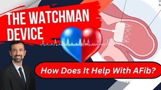 Watchman Device for AFib Procedure Details How It Works and More [upl. by Byrom]