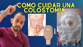 Como Cuidar una Colostomia o Ileostomia Problemas resueltos  Enf Erika Andrade  Podcast [upl. by Kamilah170]