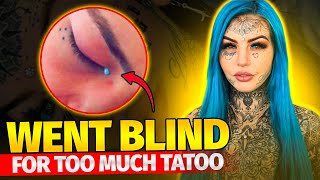 Amber Luke BLIND for Weeks After Eyeball Tattoo [upl. by Lletnahc]