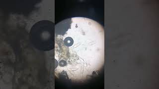 under the microscope cercariae Schistosomiasis shortvideo [upl. by Obbard959]