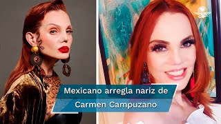 Carmen Campuzano presume su nueva nariz reconstruida por un mexicano [upl. by Hamburger]