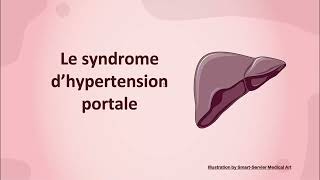 Syndrome dhypertension portale [upl. by Orsino]