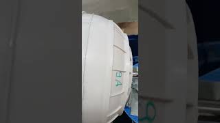 washing machine spin motor and basket cupping connectionspin solution [upl. by Argile219]