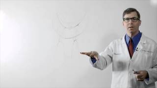 Mitral Valve Repair Explained [upl. by Singh]