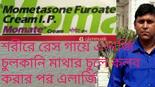 মোমেট ক্রিম ইউজ কিভাবে করবেন2021 [upl. by Terhune]