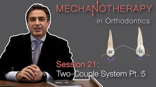 Mechanotherapy in Orthodontics TwoCouple System Pt 5 [upl. by Oidiple]