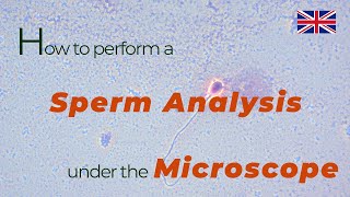 How to perform a sperm analysis under the microscope  urologist göttingen [upl. by Roehm]