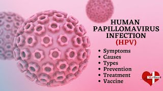 Human papillomavirus infection  HPV  What is HPV amp How do you get it [upl. by Ecidnarb]