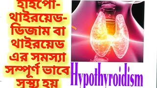 Discussion of Hypothyroidismথাইরয়েড সমস্যাits causesDiagnosis Homeopathy Treatment Management [upl. by Yednarb805]