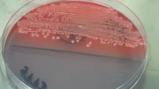 Klebsiella oxytoca on CLED Agar [upl. by Toland]