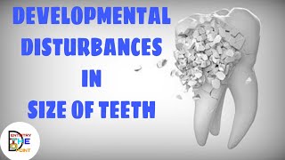 DEVELOPMENTAL DISTURBANCES IN SIZE OF TEETH [upl. by Ellingston]