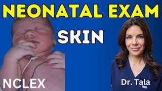 How to examine babys skin Neonatologist reviews NCLEX 7 [upl. by Roscoe584]