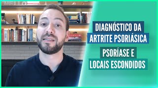 DIAGNÓSTICO DA ARTRITE PSORIÁSICA  PSORÍASE E LOCAIS ESCONDIDOS [upl. by Nisotawulo582]