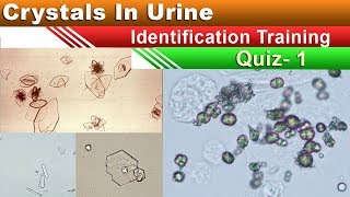 Crystals In Urine Identification Training Quiz  Part 15 [upl. by Philps]