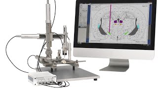 Neurostar  Robot Stereotaxic [upl. by Cleodell]