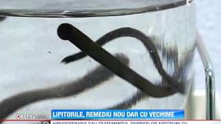 Terapia cu lipitori cea mai nouă metodă de tratament [upl. by Valencia271]