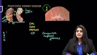 RENAL PATHOLOGY RAPID REVISION FMGEINICET NEET PG [upl. by Aiello761]