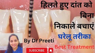 हिलते हुए दांत का घरेलू इलाजHome Remedies for loosen toothBy Dr Preeti [upl. by Enyalahs749]