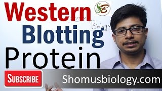 Western blotting technique  principle and step by step procedure [upl. by Niaz]