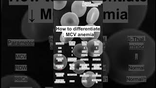 How to differentiate ↓ MCV anemia [upl. by Eliga]