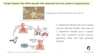 โรค cryptococcosis [upl. by Ardnasela360]