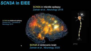 Ion Channelopathies Infantile Epilepsy amp Precision Medicine [upl. by Marcella]