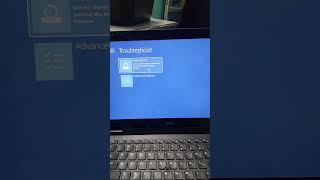 Laptop windows eroor solution technical windowsbluescreen error windows shortvideo short [upl. by Masuh]