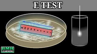 E Test  E Test For Antibiotic Susceptibility  MIC Determination By E Test  Epsilometer Test [upl. by Phil]