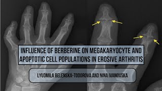 Influence of Berberine on Megakaryocyte and Apoptotic Cell Populations in Erosive Arthritis [upl. by Notterb447]