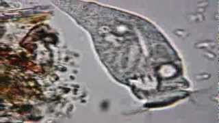 Rotifer at x600 under Celestron PentaView Digital [upl. by Lav]