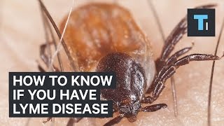 How to know if you have Lyme disease [upl. by Keare]