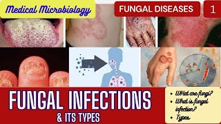 Fungal Infections and their types FungalInfections Mycoses medicalmicrobiology ringworm [upl. by Yrrak304]