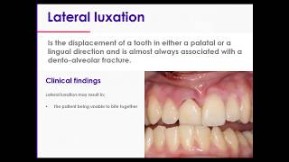 11 Traumatic Dental Injuries Part 2 Luxation Injuries Type 4 Lateral Luxations [upl. by Vevay]