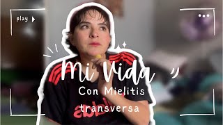 Volví ❤️‍🩹 Por esta razón dejé de caminar😞 Mi vida con Mielitis Transversa 🧠👩🏻‍🦽‍➡️ [upl. by Agace]