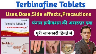 Terbinafine tablets ip 250 mg  Terbinaforce tablet uses dose side effects  फंगल इन्फेक्शन की दवा [upl. by Sinnaoi]